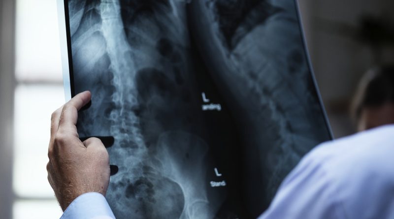 spine examination