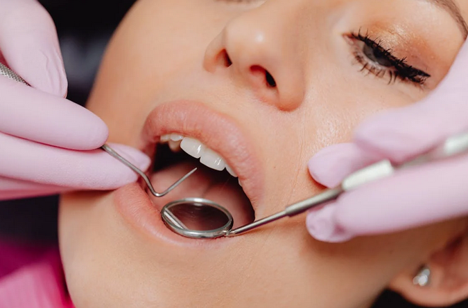 dental checkup